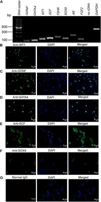 Hsa-miR-100-3p Controls the Proliferation, DNA Synthesis, and Apoptosis of Human Sertoli Cells by Binding to SGK3